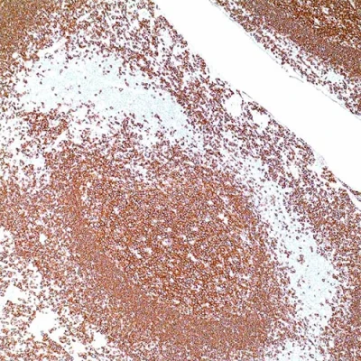آنتی بادی CD20 کلون L26 برند PathoSage