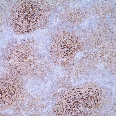 آنتی بادی CD21 کلون CR2/2754 برند PathoSage