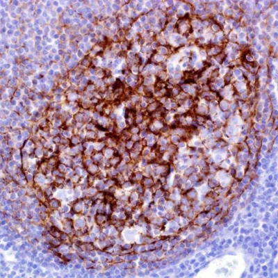 آنتی بادی CD21 کلون 2G9 برند PathoSage