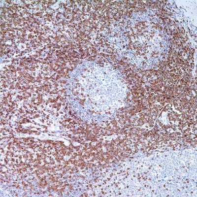آنتی بادی CD3 کلون Polyclonal برند PathoSage