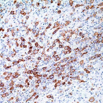 آنتی بادی CD30 کلون BER-H2 برند PathoSage