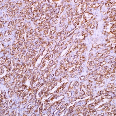آنتی بادی CD31(PECAM-1) کلون C31.3 برند PathoSage