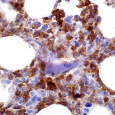 آنتی بادی CD33 کلون PWS44 برند PathoSage