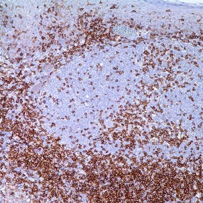 آنتی بادی CD4 کلون 3619R برند PathoSage
