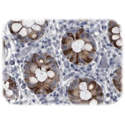 آنتی بادی Cytokeratin 20 کلون Ks20.8 برند Quartett