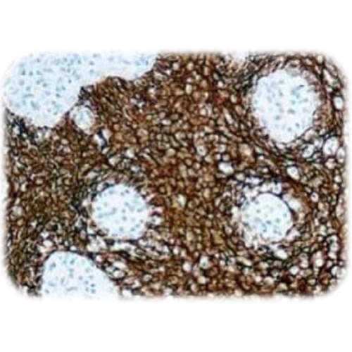 آنتی بادی Cytokeratin PAN کلون MNF-116 برند Quartett