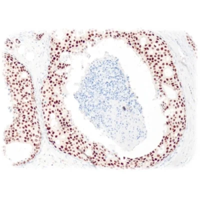 آنتی بادی ER(Estrogen Receptor) کلون QR013 برند Quartett