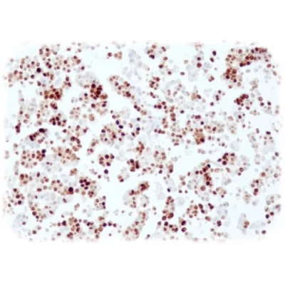 آنتی بادی PR(Progesterone Receptor) کلون QR014 برند Quartett