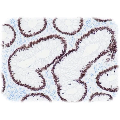آنتی بادی SATB2(DNA-Binding Protein SATB2) کلون QR023 برند Quartett