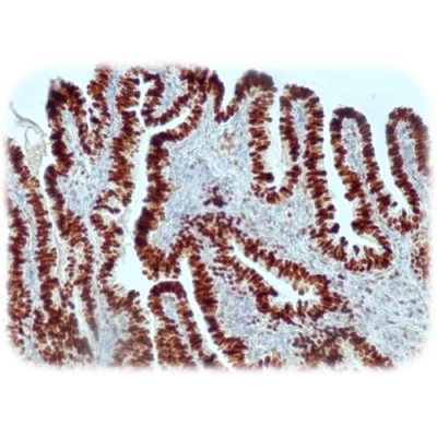آنتی بادی WT1(Wilms Tumor) کلون QR030 برند Quartett
