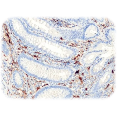 آنتی بادی S100 Protein کلون QR031 برند Quartett