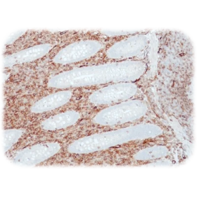 آنتی بادی CD31(PECAM-1) کلون QR034 برند Quartett