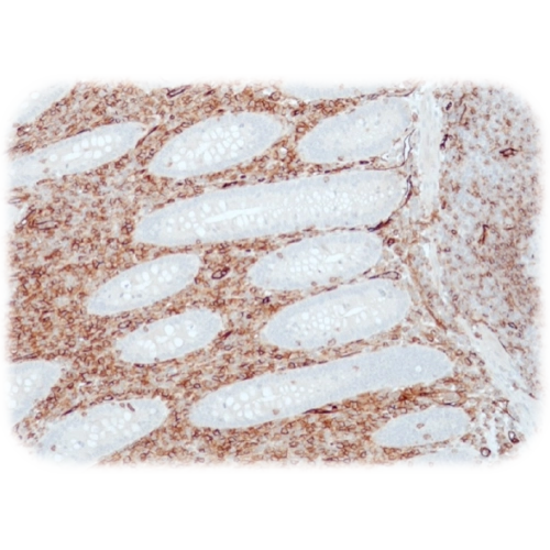 آنتی بادی CD31(PECAM-1) کلون QR034 برند Quartett
