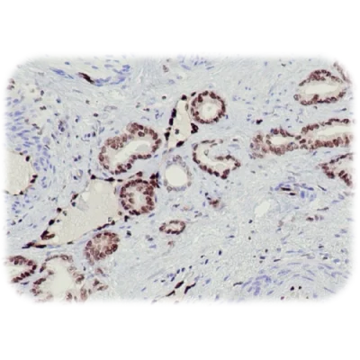 آنتی بادی Transcriptional Regulator ERG کلون QR040 برند Quartett