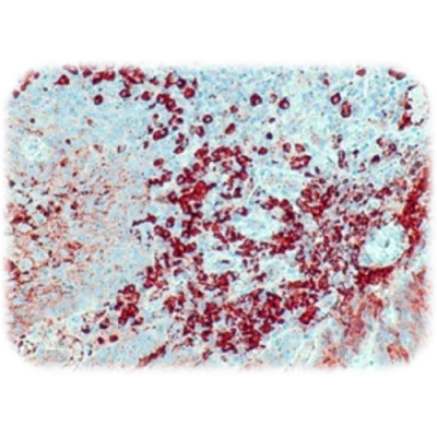 آنتی بادی Kappa Immunoglobulin Light Chain کلون QR051 برند Quartett