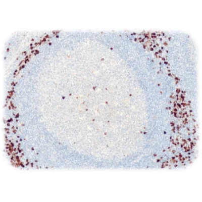 آنتی بادی Lambda Immunoglobulin Light Chain کلون QR052 برند Quartett