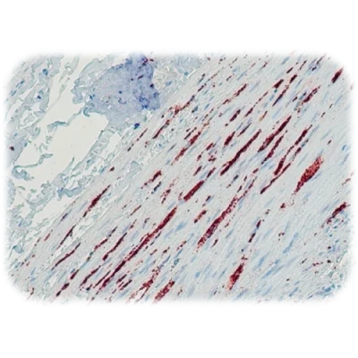 آنتی بادی Synaptophysin کلون QR054 برند Quartett
