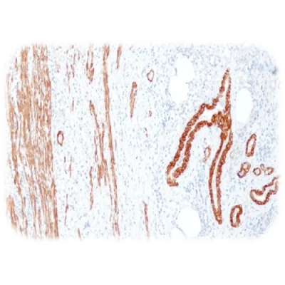 آنتی بادی Smooth Muscle Myosin, heavy chain کلون QR064 برند Quartett