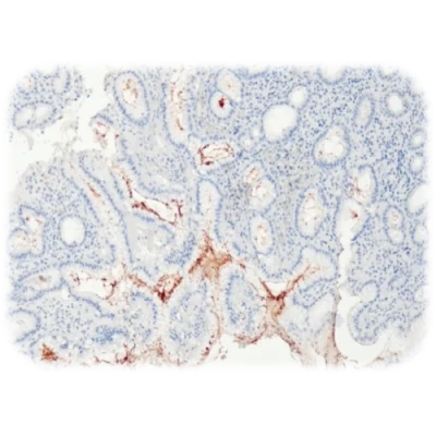 آنتی بادی Helicobacter Pylori کلون QR091 برند Quartett