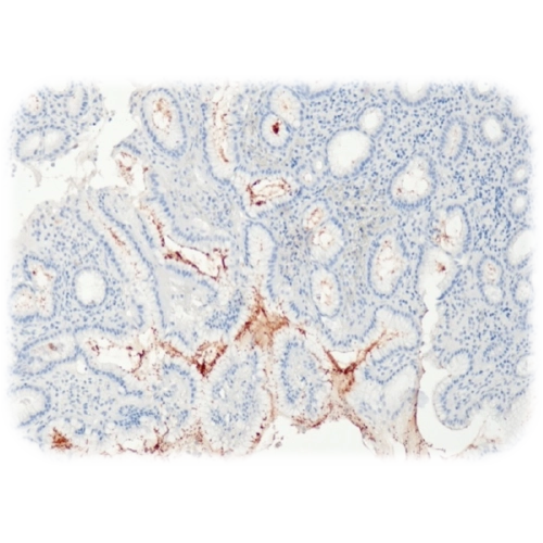 آنتی بادی Helicobacter Pylori کلون QR091 برند Quartett