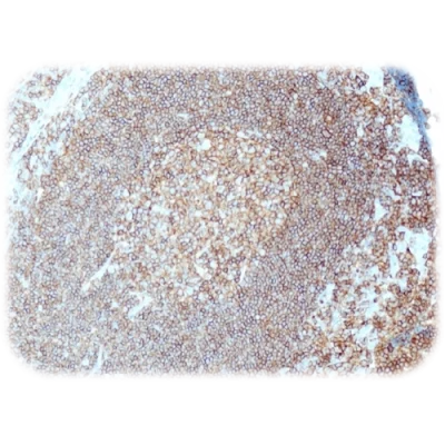 آنتی بادی CD45(LCA) کلون QR106 برند Quartett