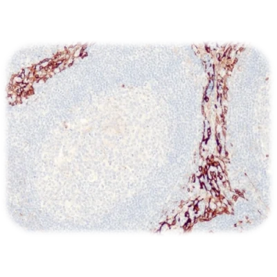 آنتی بادی Cytokeratin 8 کلون QR112 برند Quartett