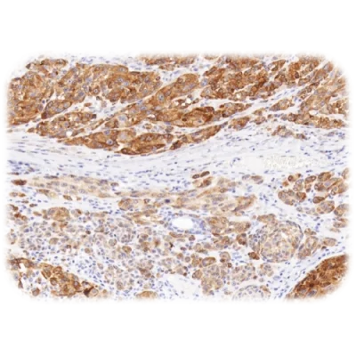 آنتی بادی Tyrosinase کلون T311 برند Quartett