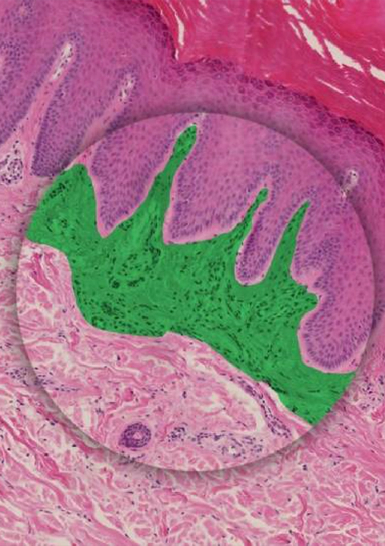 رنگ آمیزی H&E